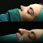Esteticderm - Skin Treatment Center - Facial care and Laser Hair Removal - Soprano Ice Platinum - Nişantaşı Istanbul thumb 6